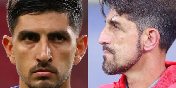 El corte en la ceja que tiene Paunovic habría sido provocada por Víctor Guzmán